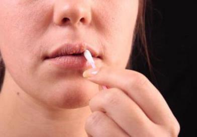 Чем мазать простуду на губах в домашних условиях?