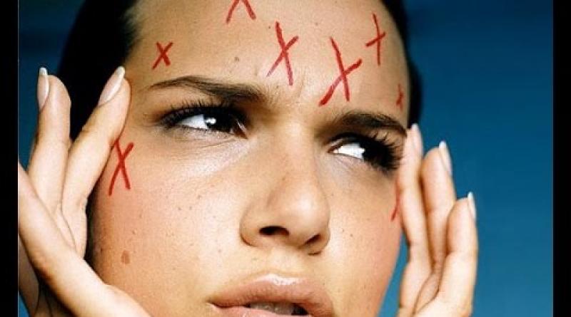 Por qué el acné en los adolescentes se trata de manera diferente que en los adultos