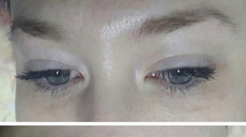 Hjälper ricinolja ögonbrynen: egenskaper, sammansättning och appliceringsmetoder
